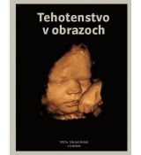 Tehotenstvo v obrazoch