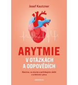 Arytmie v otázkách a odpovědích