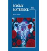 Myómy maternice