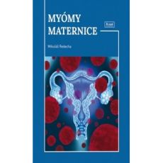 Myómy maternice